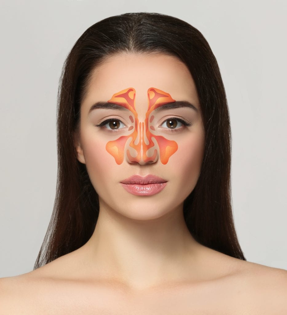 woman shown with sinuses 