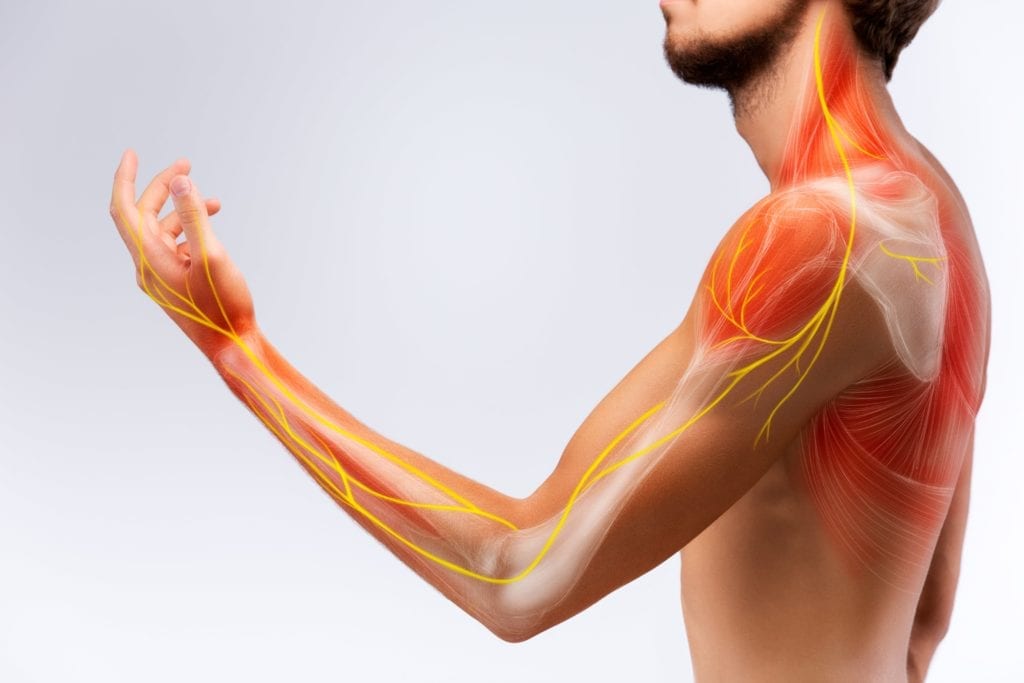 nerve shown running down from spine into the arm to the fingers
