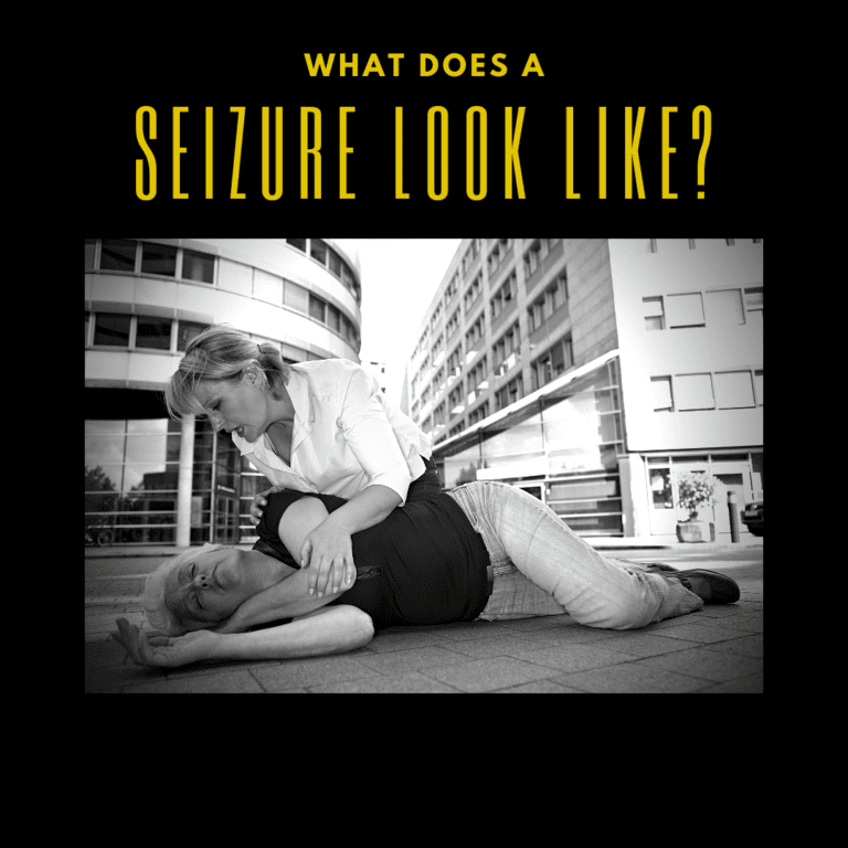 What Does A Seizure Look Like_