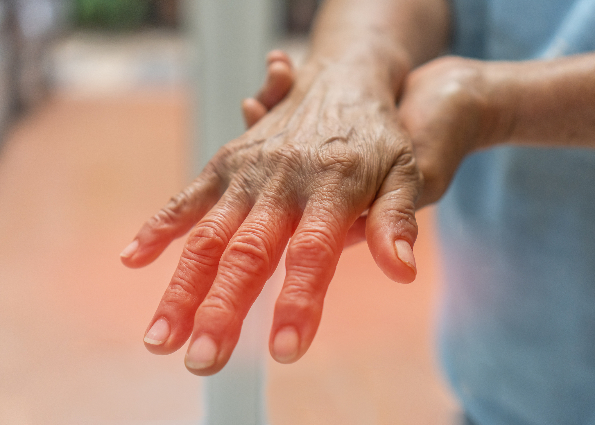How Can I Manage Peripheral Neuropathy In My Daily Life?