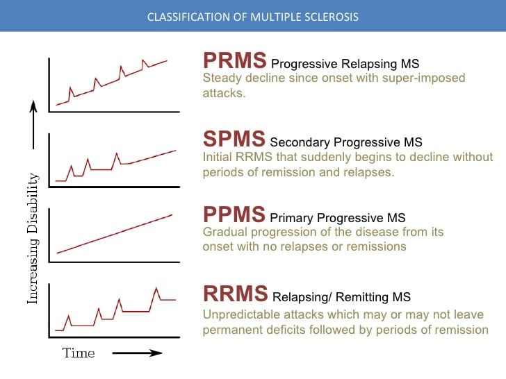 presentation of relapsing remitting multiple sclerosis
