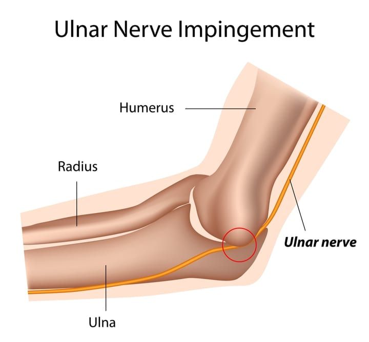 ping in the ulnar nerve