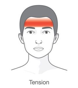 graphic of headache affected area