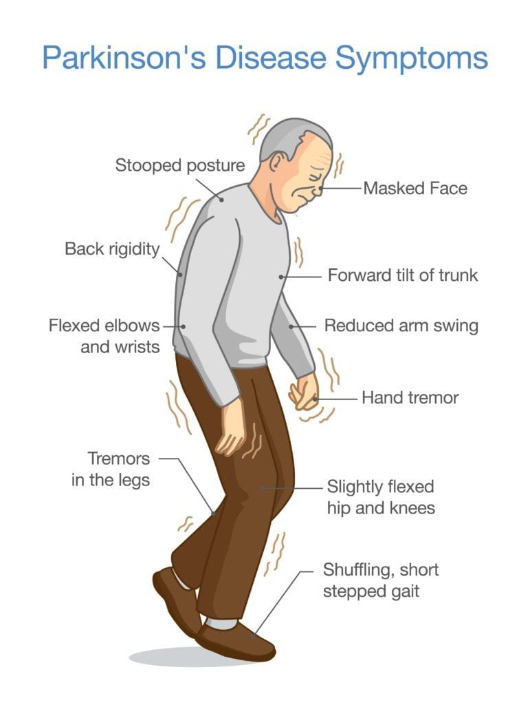 diagram showing parkinson's disease symptoms