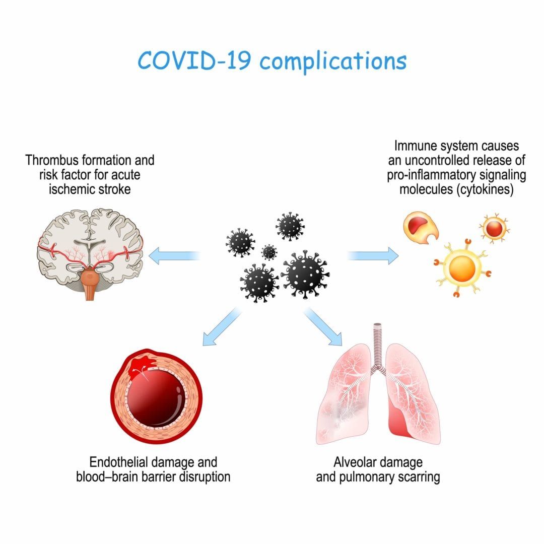 COVID-19 And The Brain: How COVID-19 Reaches The Brain - Premier ...