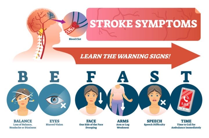 after effects of stroke