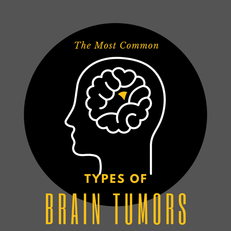 The Most Common types of brain tumors