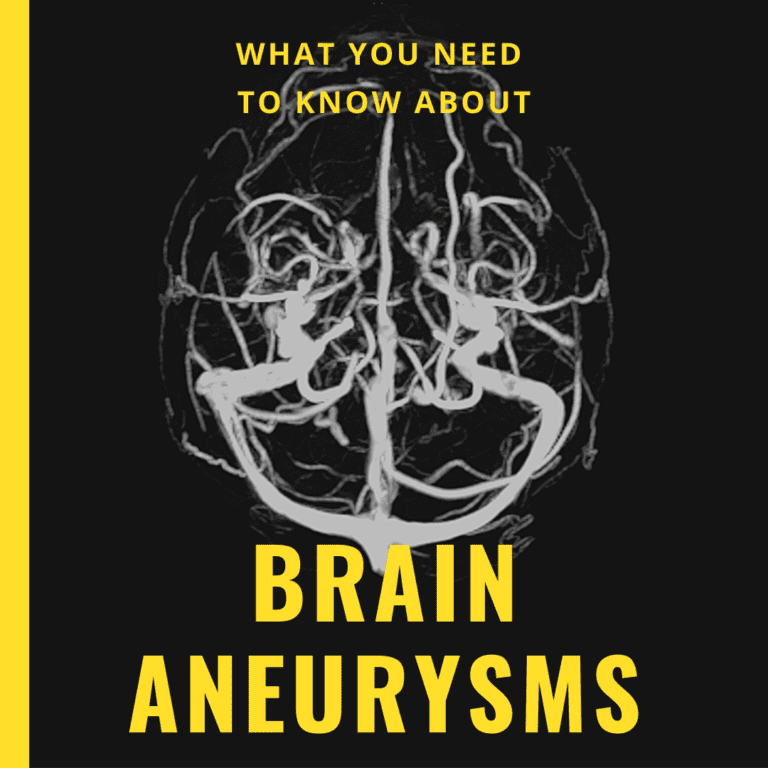 What You Need to Know About brain aneurysms