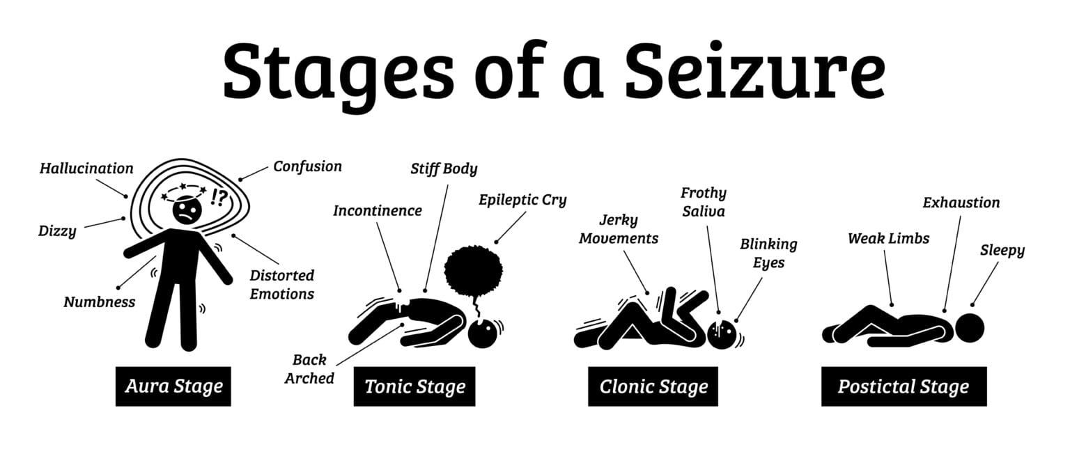 classification-of-seizures-gram-project