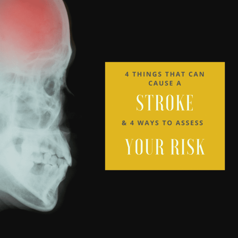 4 Things That Can Cause a stroke
