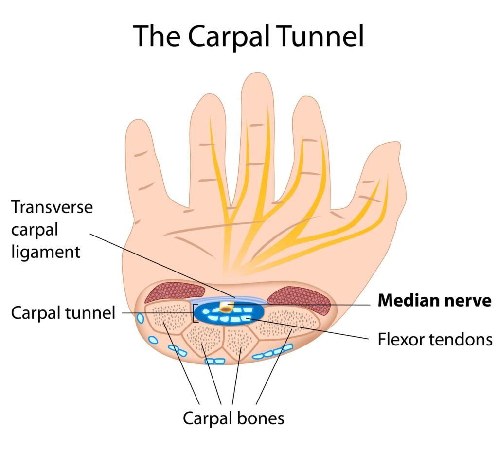 the carpal tunnel in the wrist
