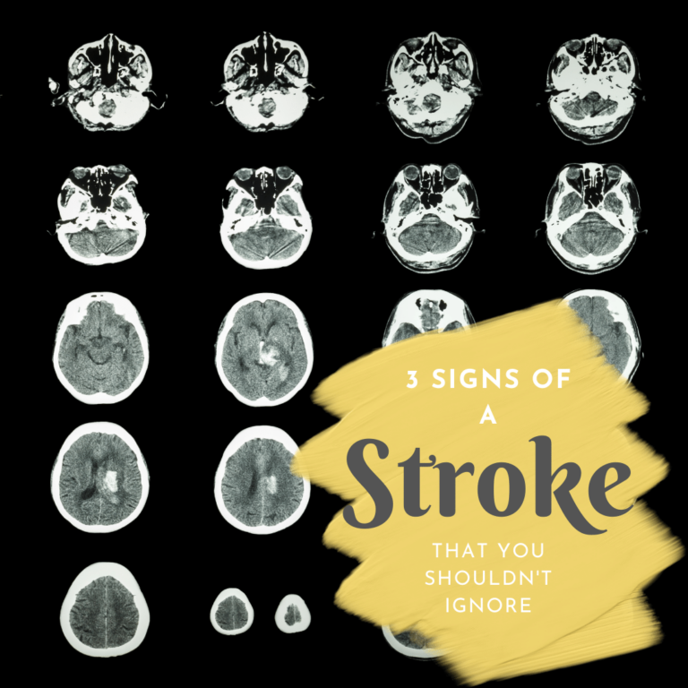 3 Signs of a Stroke That You Shouldn't Ignore
