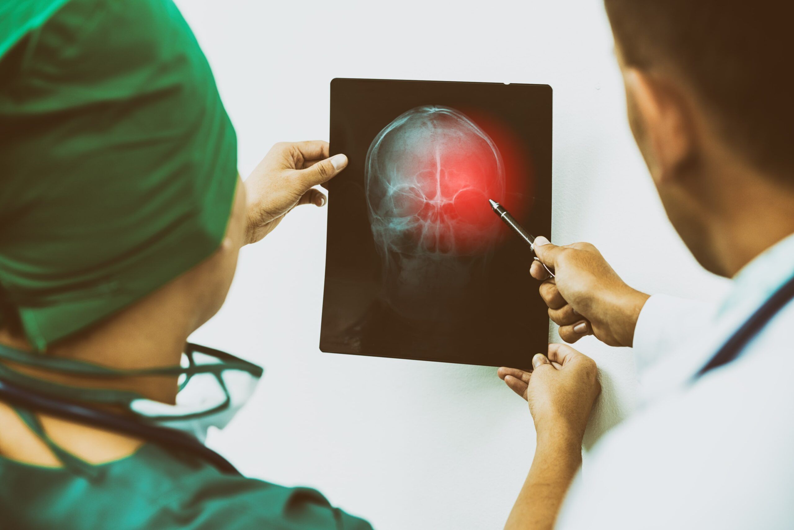 Doctor and surgeon examining x-ray film of patient 's head for brain, skull or eye injury. Medical diagnosis and surgical treatment concept.